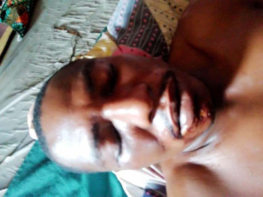 Suspected political thugs hack PDP agent to death in Kogi